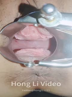 看看阴道里面啥样子